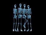 Radiografía a cuatro futbolistas